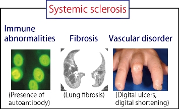 Pathological conditions of systemic sclerosis