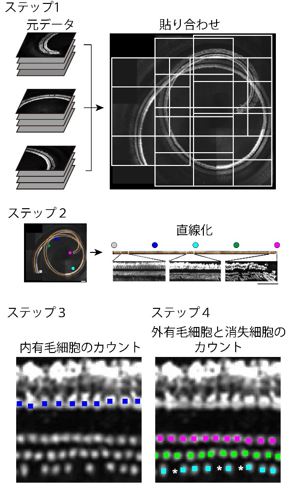 図2：全有毛細胞検出のためのプログラムの概略