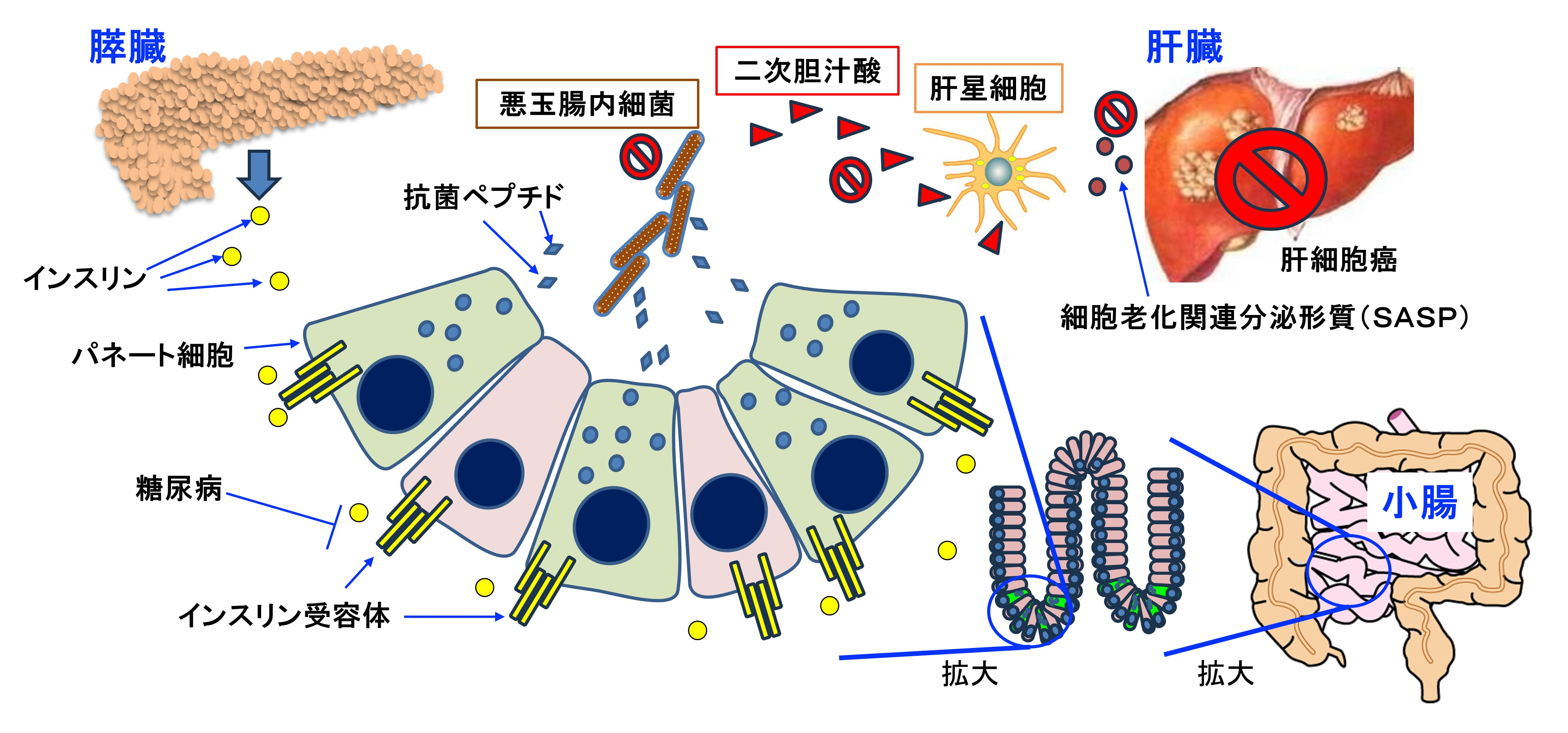 図：腸におけるインスリン作用が脂肪性肝炎を伴う糖尿病における肝細胞癌の発症を防ぐ