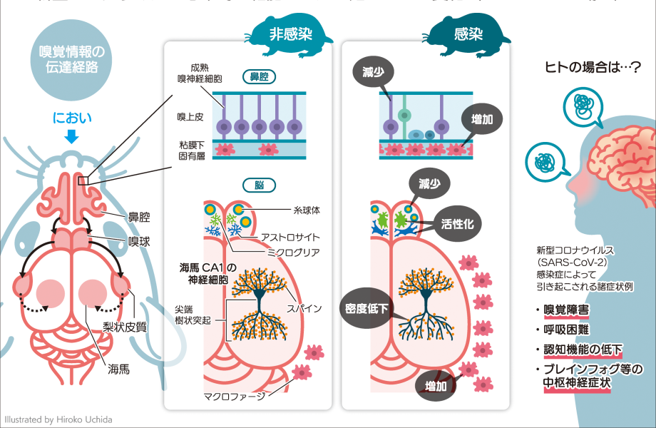 新型コロナウイルス（SARS-CoV-2）感染モデルにおける脳の変化