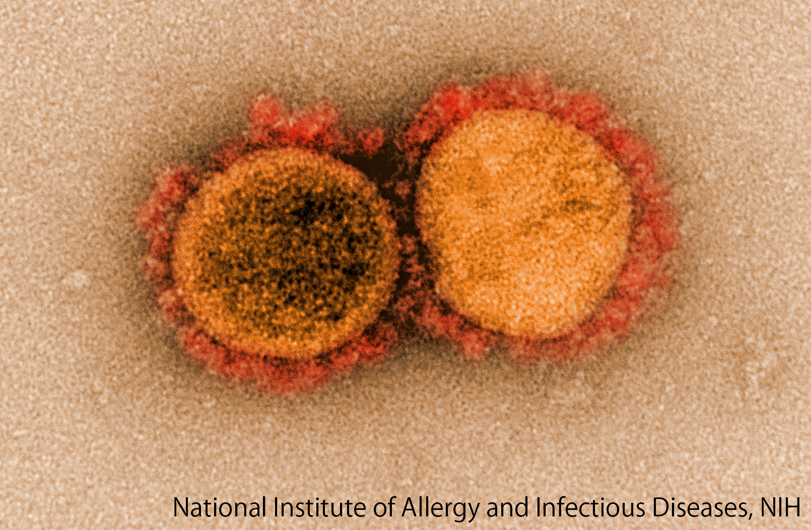 新型コロナウイルス感染症―病気を知って、感染対策を考える―
