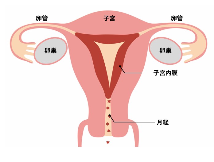 子宮 内 膜 掻爬 を すると