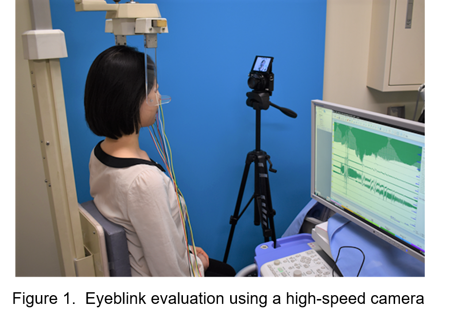 Eyeblink evaluation using a high-speed camera