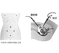 子宮体癌に対する腹腔鏡下手術