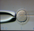 若年がん患者の妊孕性温存のための卵子・胚凍結保存