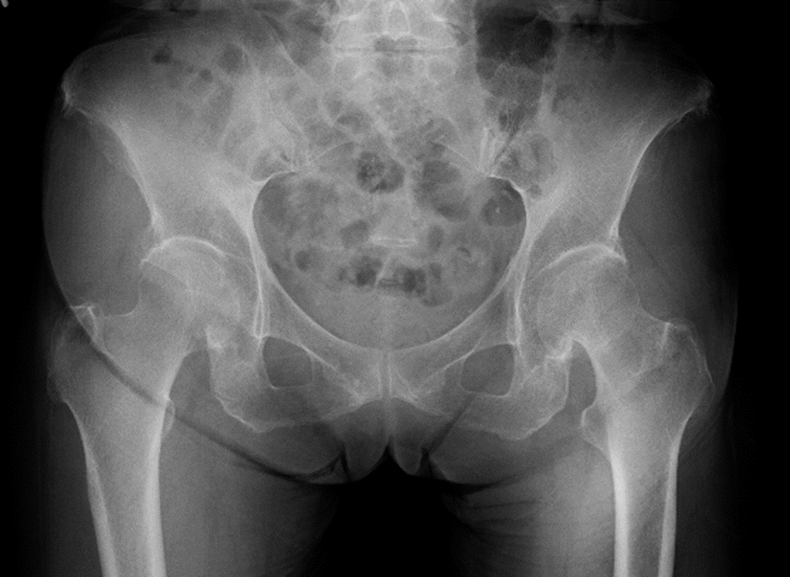 大腿骨近位部骨折に対する多職種協働診療の取り組み 