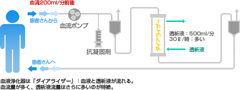 血液透析の回路（図）