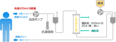 血液濾過透析 イメージ図