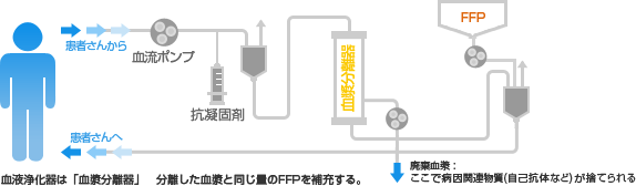 血漿交換の回路（図)