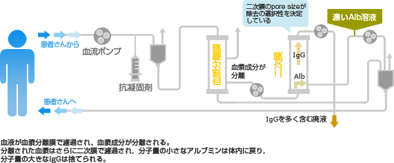 DFPPの回路（図）